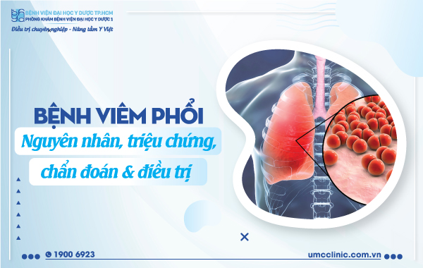 Lời khuyên và đề xuất từ chuyên gia