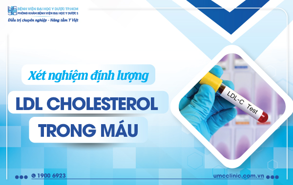 Xét nghiệm LDL Cholesterol là gì? Tìm hiểu chi tiết về xét nghiệm LDL