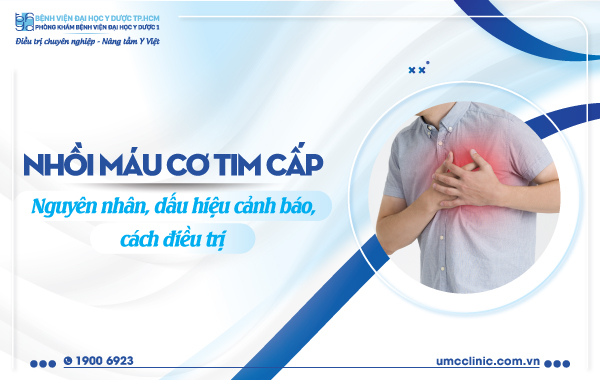 3. Cách Điều Trị Nhồi Máu Cơ Tim