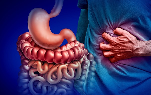 Bệnh Crohn Là Gì Pk Bệnh Viện Đại Học Y Dược 1 